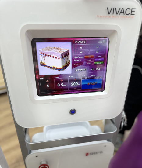 Микроигольчатый RF лифтинг на аппарате Vivace